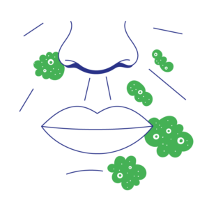 Pharmacy First - Impetigo